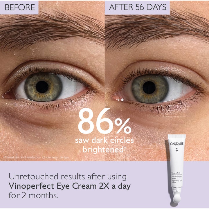 Caudalie Vinoperfect Brightening Eye Cream 15 ml lyxig ögonkräm mot mörka ringar visar före och efter resultat