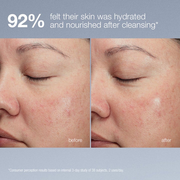 Dermalogica Magnetic Afterglow Cleanser Duo ansiktsrengöring med före och efter resultat på återfuktad hud