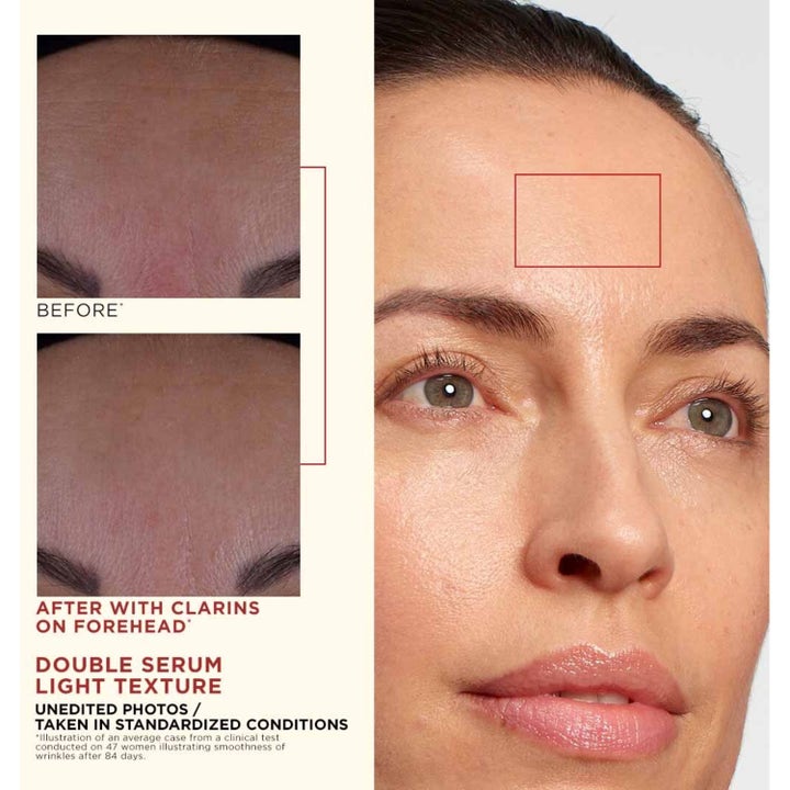 Clarins Double Serum Light Texture 50 ml anti age koncentrat visar före och efter resultat på rynkor i pannan.