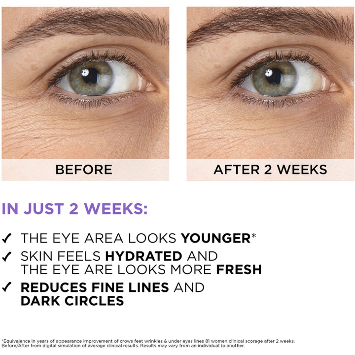 L'Oréal Paris Filler Eye Serum 20 ml anti-age ögonserum koffein visar resultat före och efter på fina linjer.