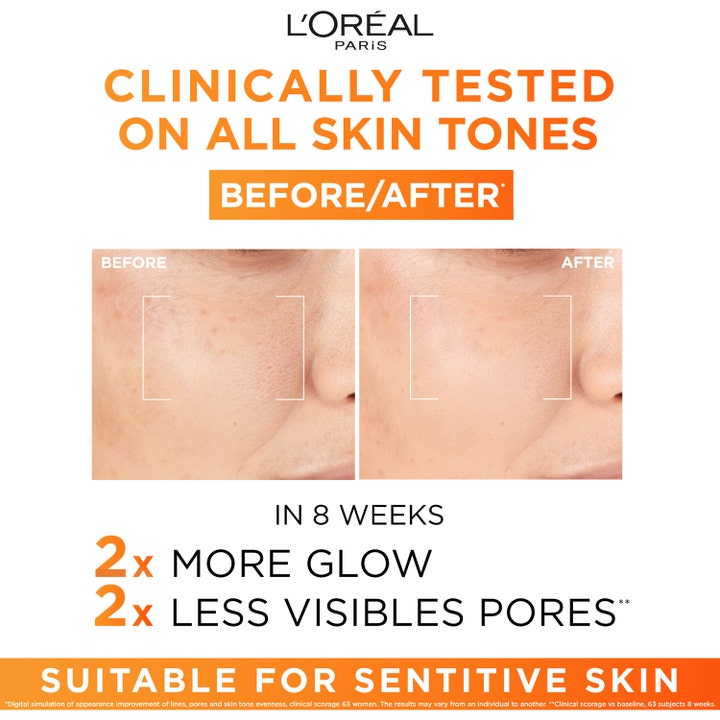 L'Oréal Paris Revitalift Clinical 12% Vitamin C Serum 30 ml före och efter som visar mer lyster och mindre porer.
