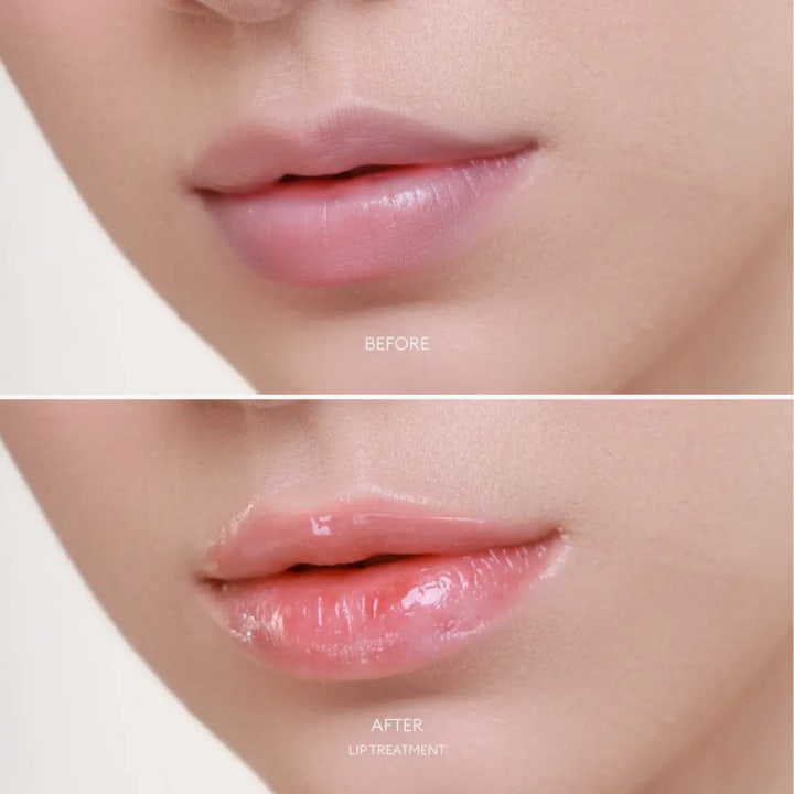 Lip Treatment Hydrating Lip Balm