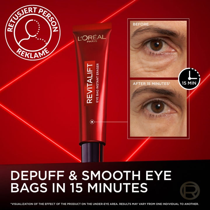 L'Oréal Paris Revitalift Laser Eye Bag Eraser 15 ml ögonkräm i röd tub med före och efter resultatbilder.