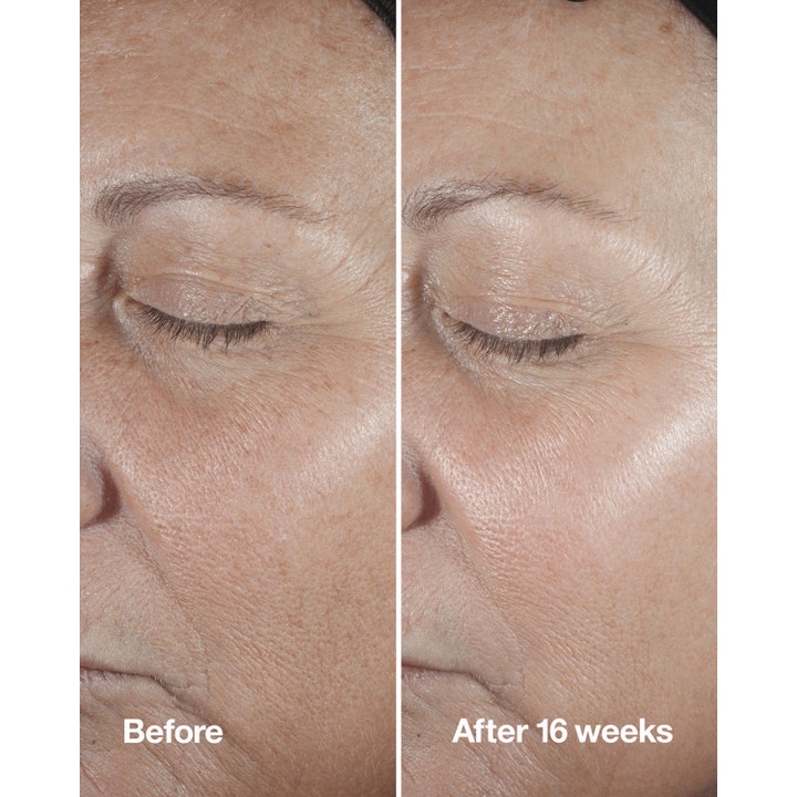 Clinique Smart Clinical Repair Wrinkle Correcting Serum 30 ml anti-aging serum före och efter 16 veckor