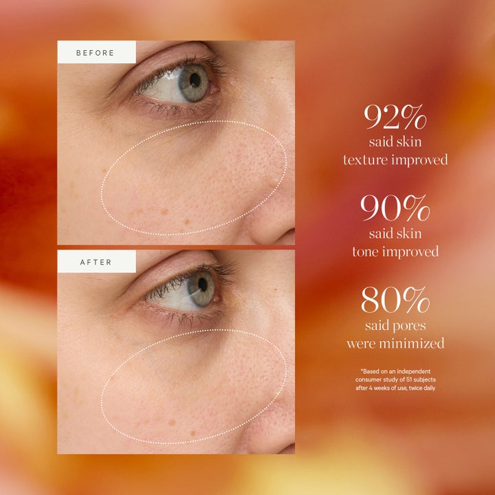 KORA Organics Turmeric Glow Drops 30 ml niacinamide alternative serum med före- och efterbilder på minskade porer.
