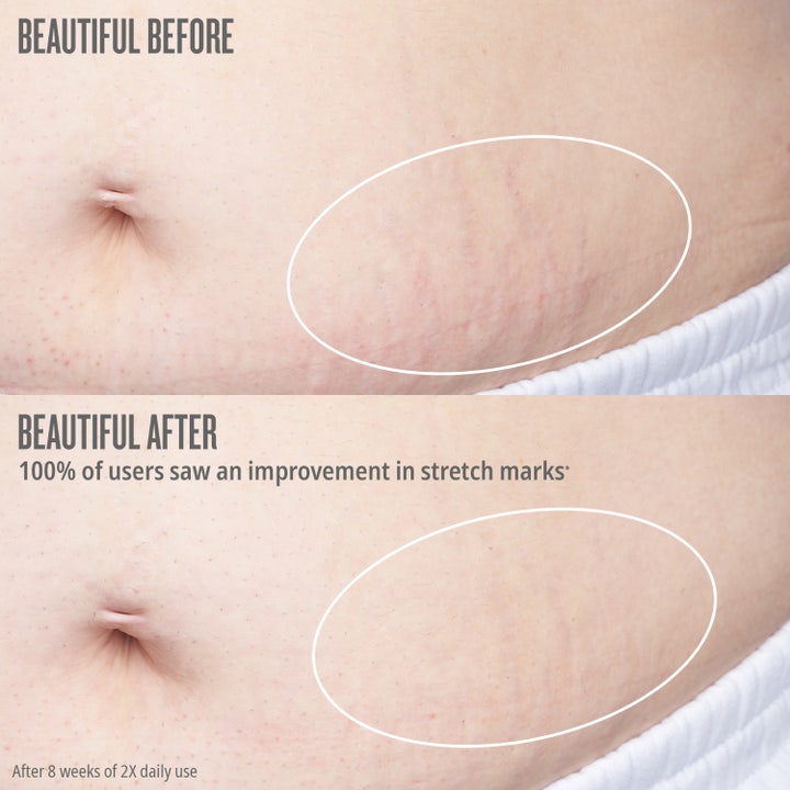 Bum Bum Body Firmeza Oil