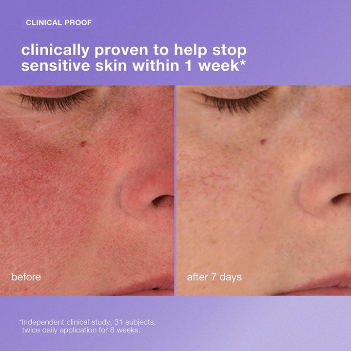 Dermalogica Stabilizing Repair Cream 100 ml lugnande ansiktskräm visar dämpad rodnad på före- och efterbilder.