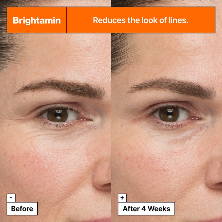 Dr.Jart+ Brightamin Brightening Serum Ampoule 8,08 g minskar synliga linjer i en före och efter jämförelse.