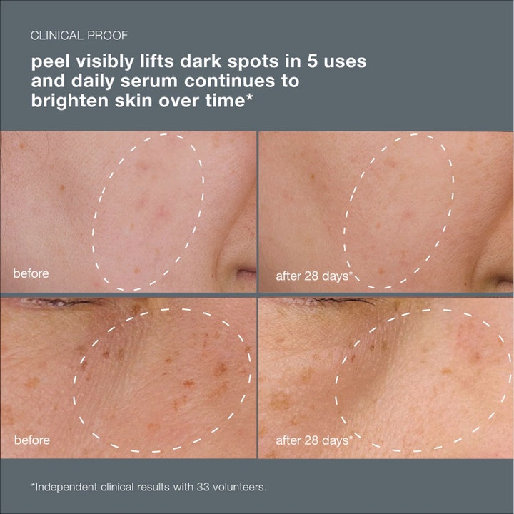 Dermalogica PowerBright Dark Spot System visar kliniska före- och efterbilder på pigmentfläckar efter 28 dagar.