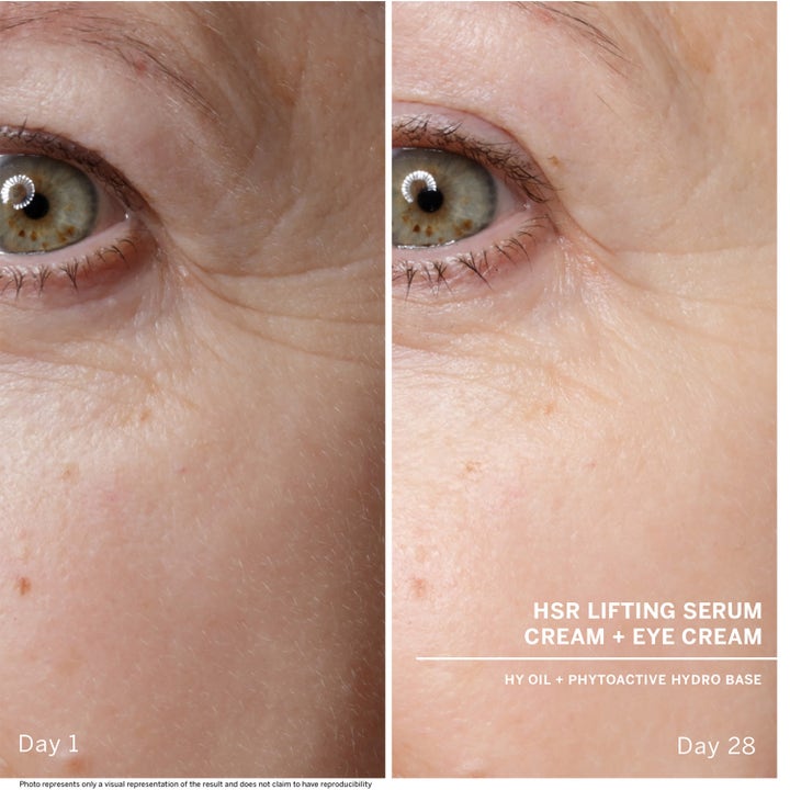 Babor HSR Lifting Serum 30 ml anti-age lyftserum mot antirynkor visar huden före och efter tjugoåtta dagars användning
