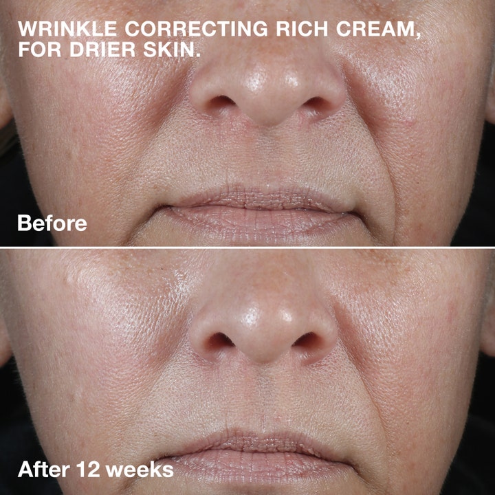 Clinique Smart Clinical Repair Wrinkle Face Cream Rich 50 ml anti rynkor kräm före och efter 12 veckors användning