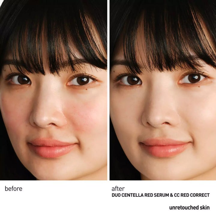 Erborian Centella Red Serum 30 ml lugnande ansiktsserum före och efter resultat på rodnad i ansiktet