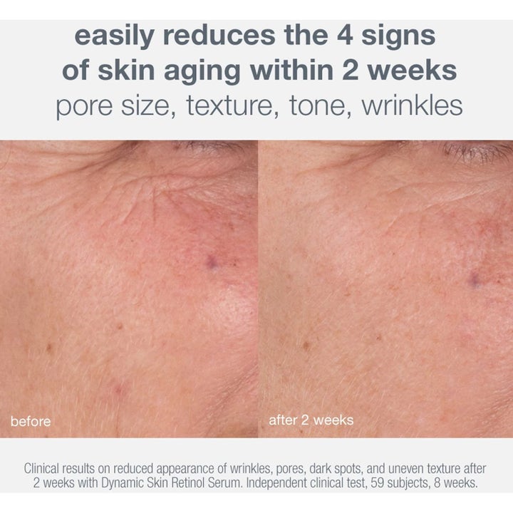 Dermalogica Skin Aging Solutions Duo hudvård före och efter resultat som ger minskade rynkor och porer på två veckor