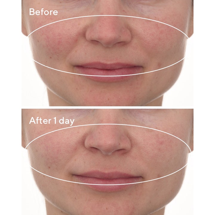 Murad Cellular Hydration Repair Mask 80 ml fuktgivande ansiktsmask visar minskad rodnad på före- och efterbilder.