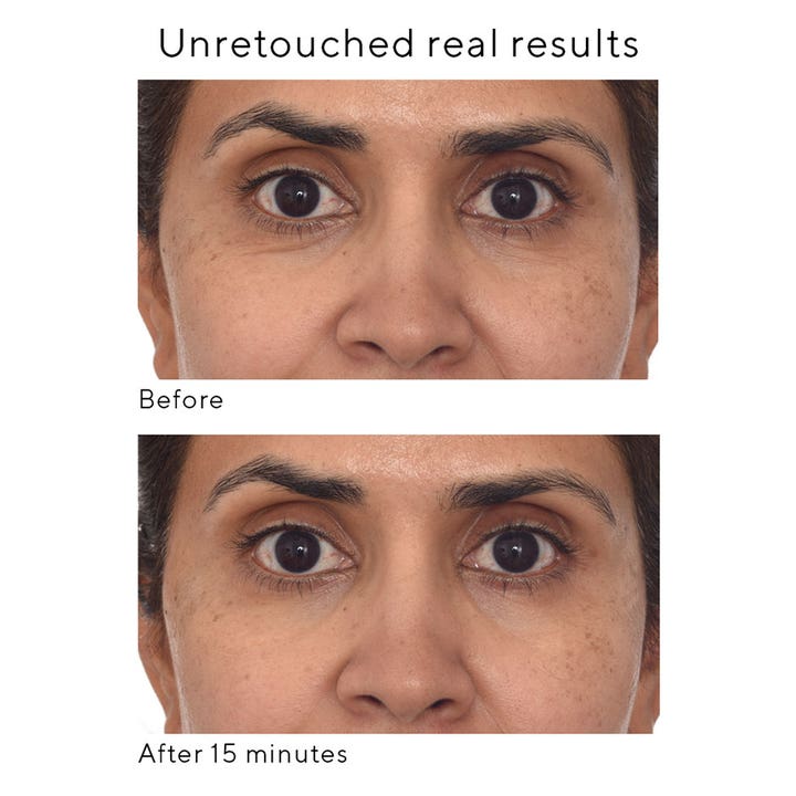 Murad Retinol Youth Renewal Eye Mask 5 st föryngrande ögonmask mot ålderstecken visar resultat efter 15 minuter.