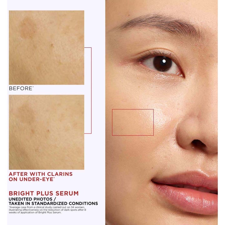 Clarins Bright Plus Serum 30 ml ger lyster och visar resultat före och efter på mörka fläckar under ögat.