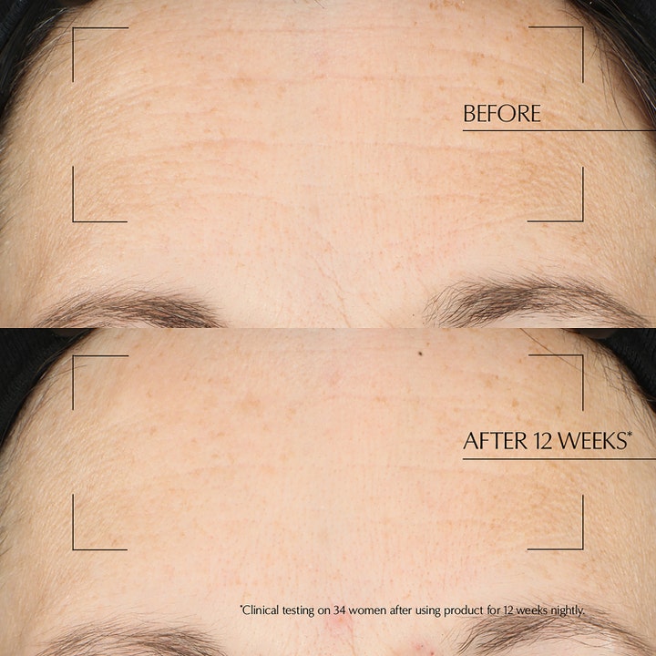 Estée Lauder Advanced Night Repair 65 ml reparerande återfuktande nattmask visar före och efter resultat på rynkor i pannan.