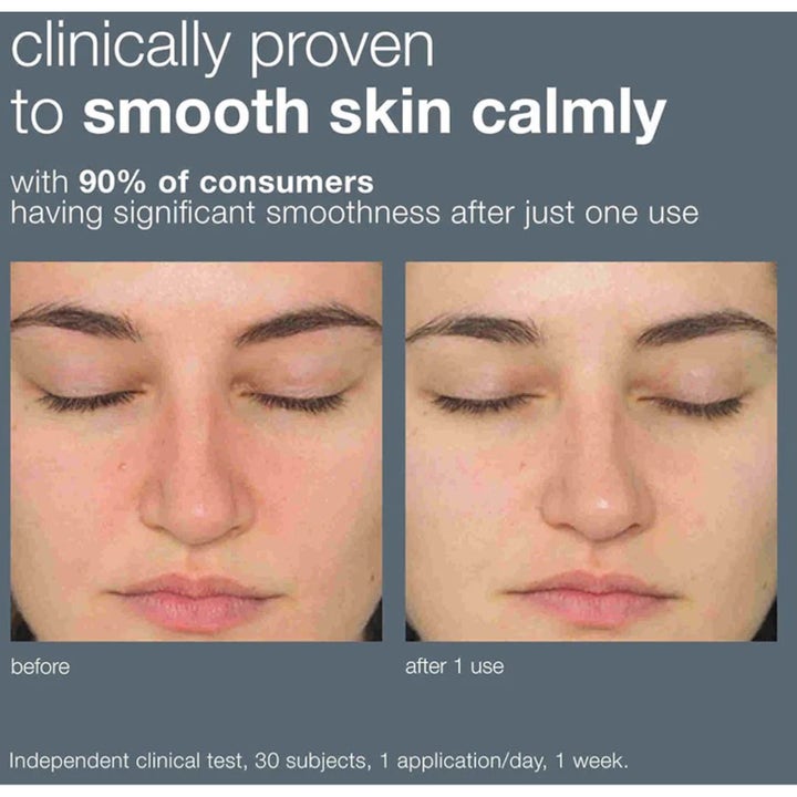 Dermalogica Daily Milkfoliant 74 g peeling visar kliniskt bevisat resultat för en lugnare och slätare hy före och efter.