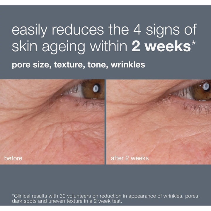 Dermalogica Dynamic Skin Retinol Serum 30 ml visar före och efter resultat på rynkor kring ögat.