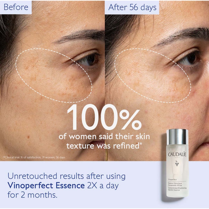 Caudalie Vinoperfect Essence 100 ml ger lyster och visar före och efter-resultat på jämnare hudtextur efter 56 dagar.