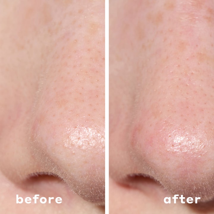 Mario Badescu 2-In-1 Deep Cleansing Pore Strip 6 st djuprengörande porplåster visar före och efter resultat på näsan