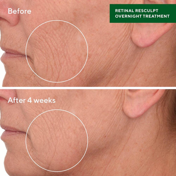 Murad Retinal ReSculpt Treatment 30 ml åldringshämmande retinal serum visar synlig förbättring av rynkor efter 4 veckor