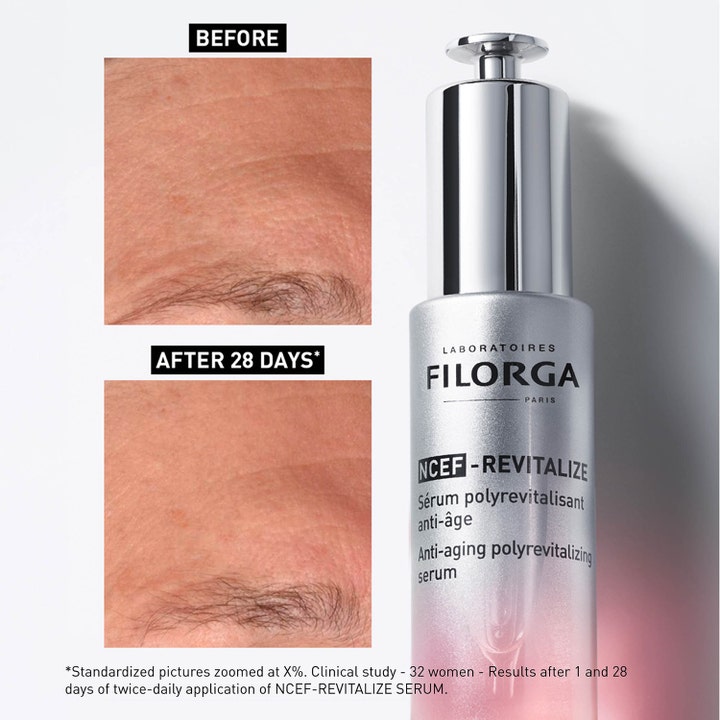 Filorga NCEF-Revitalize Serum 30 ml antiaging serum för alla hudtyper visar före- och efterresultat på rynkor.