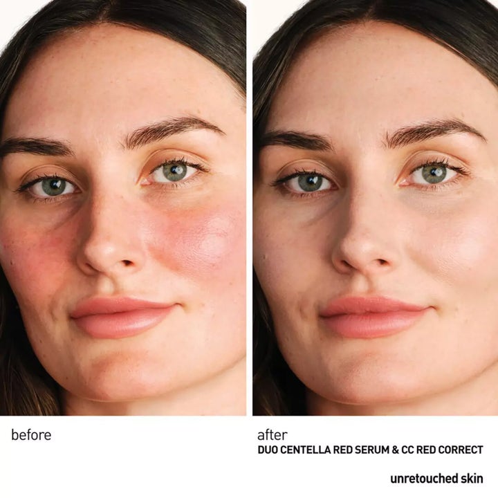 CC Red Correct