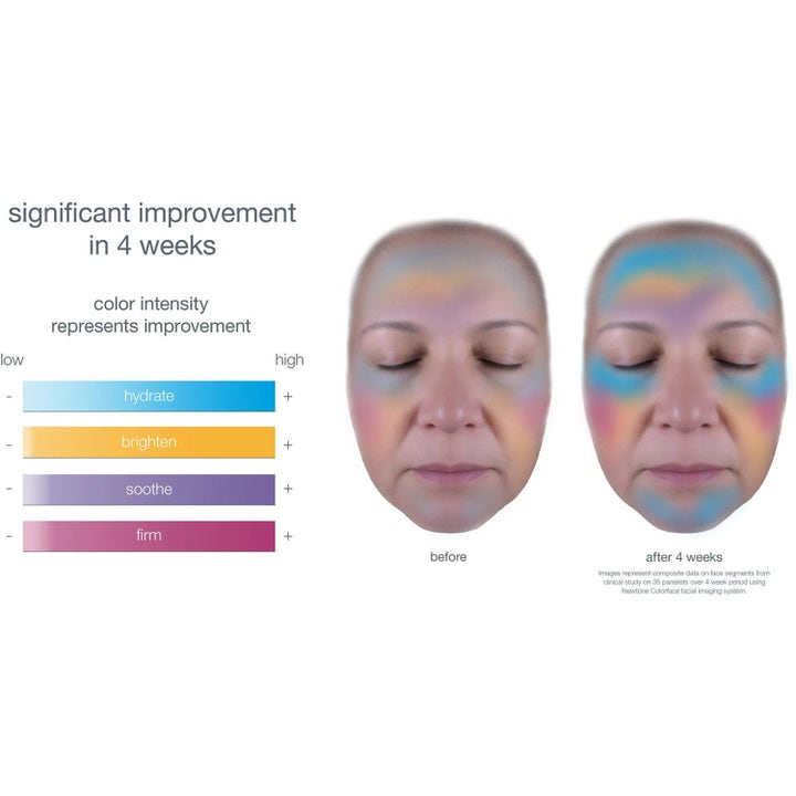 Dermalogica Smart Response Serum före och efter bilder som visar förbättrad återfuktning och lyster efter 4 veckor.