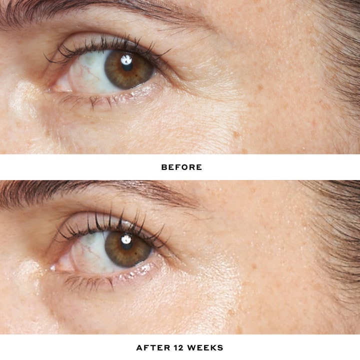 Ole Henriksen Double Rewind 0.3% Retinol Serum 30 ml minskar rynkor i en före- och efterbild efter 12 veckor.