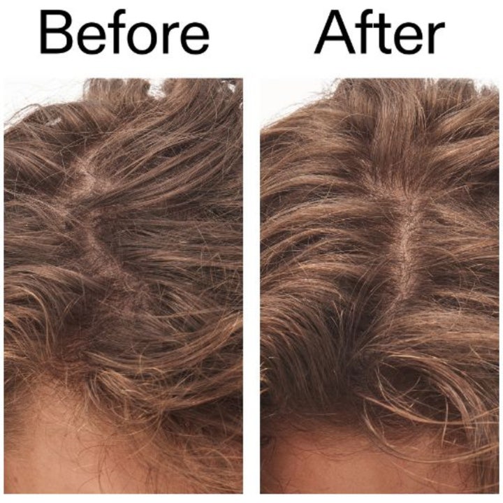 Glycolic Acid Exfoliating Scalp Scrub