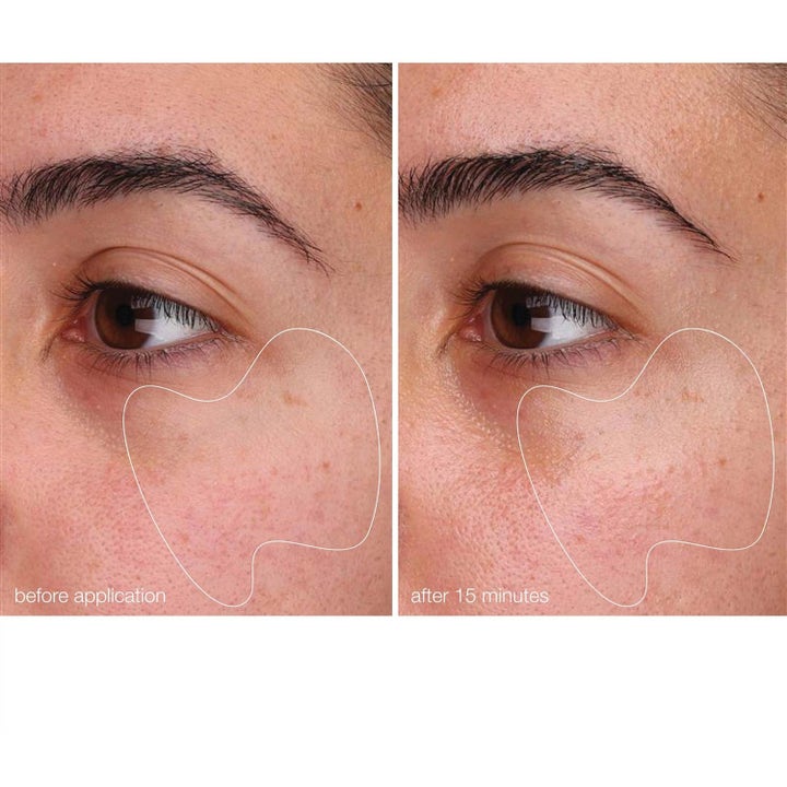 Dermalogica BioLumin-C Gel Moisturizer Duo lystergivande ansiktskräm före och efter resultat på huden.
