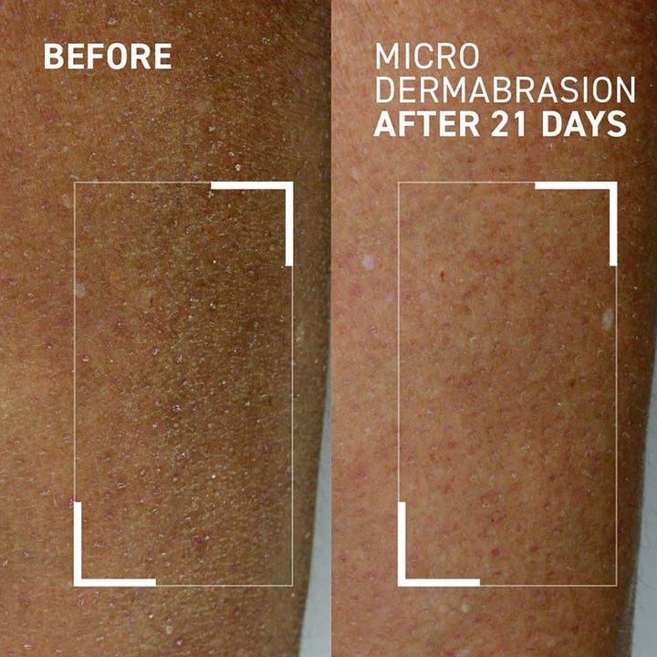 Dr Brandt Microdermabrasion Body Exfoliator 100 g kroppspeeling visar synliga resultat före och efter 21 dagar