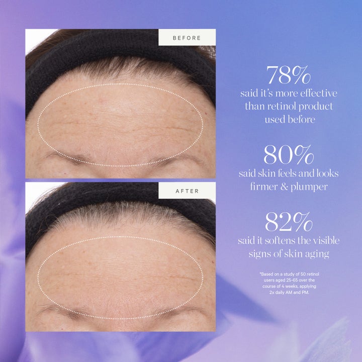 KORA Organics Plant Stem Cell Retinol Alternative Serum 10 ml före och efter resultat av växtbaserat retinol.