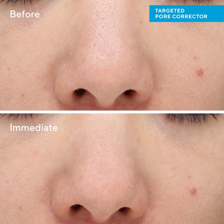 Murad Targeted Pore Corrector 15 ml porkorrigerare visar före och efter resultat på synliga porer.