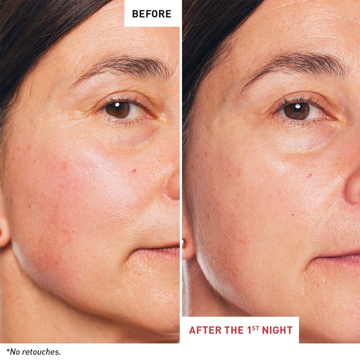 Erborian Skin Therapy Night Oil Serum 30 ml nattserum visar före och efter resultat på rynkor och hudton.