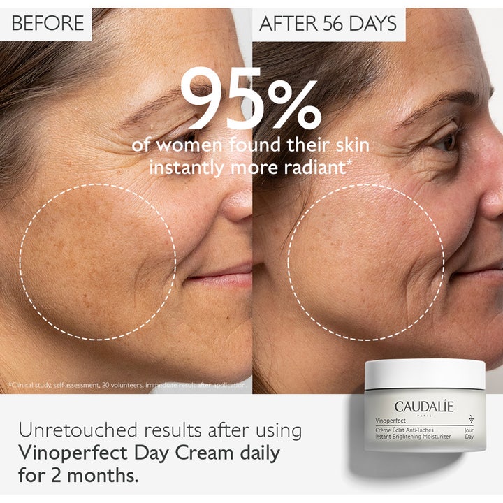 Caudalie Vinoperfect 50 ml lysterkräm ger fläckborttagning ansikte visat med före- och efterbilder på pigmentfläckar.