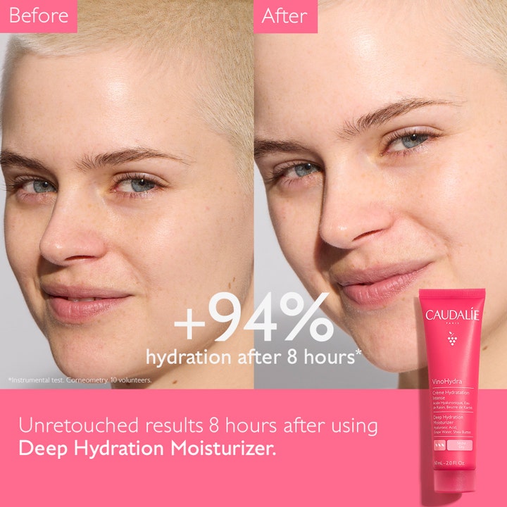 Caudalie Vinohydra Deep Hydration Moisturizer 60 ml djup återfuktande ansiktskräm visar före och efter resultat på hud