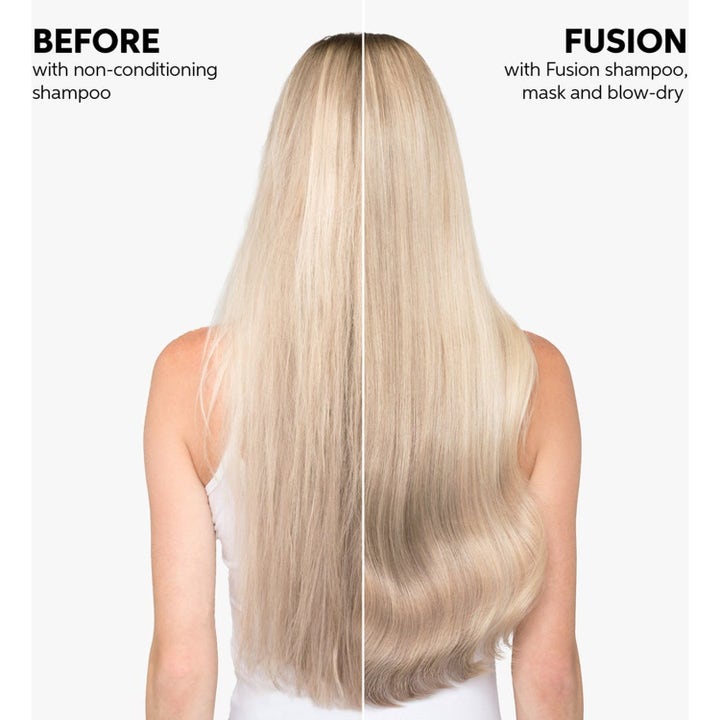 Invigo Fusion Set