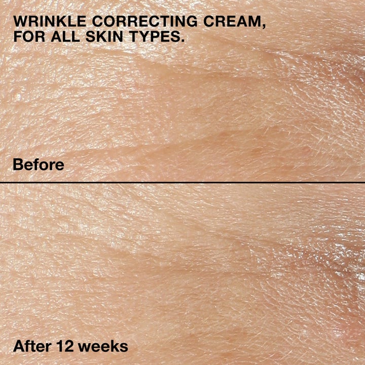 Clinique Smart Repair 115 ml ansiktskräm ger synlig rynkkorrigering före och efter 12 veckors användning.