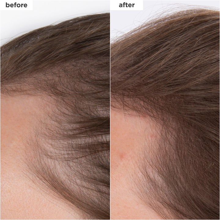 Destined for Density™ Peptide Density Serum
