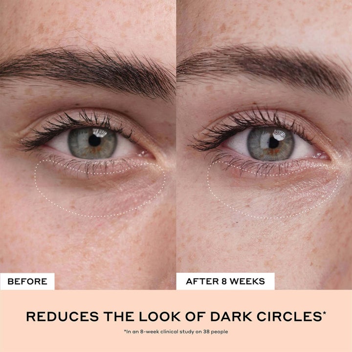 Ole Henriksen Clinical Quick Fix Mini Set 14 ml med vitamin C visar minskade mörka ringar i en före och efter bild