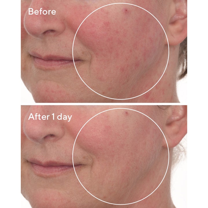 Murad Cellular Hydration Repair Mask 80 ml cellreparationsmask ger synligt minskad rodnad efter en dags användning.