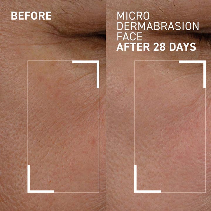 Dr Brandt Microdermabrasion Face Exfoliator 60 g ansiktspeeling för finare hudstruktur visar resultat före och efter 28 dagar.
