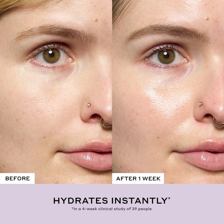 Ole Henriksen Strength Aprés-Skin Rich Rescue Treatment 75 ml ger lyster i före och efter-bild på hud.