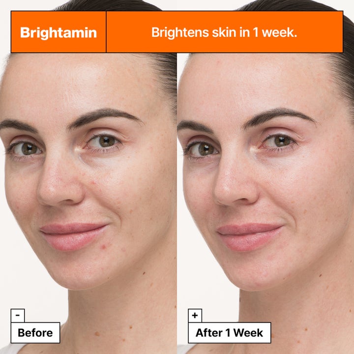 Dr.Jart+ Brightamin Brightening Serum 8,08 g visar före och efter resultat för lystergivande hudvård.