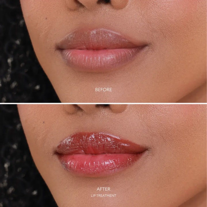 Lip Treatment Hydrating Lip Balm