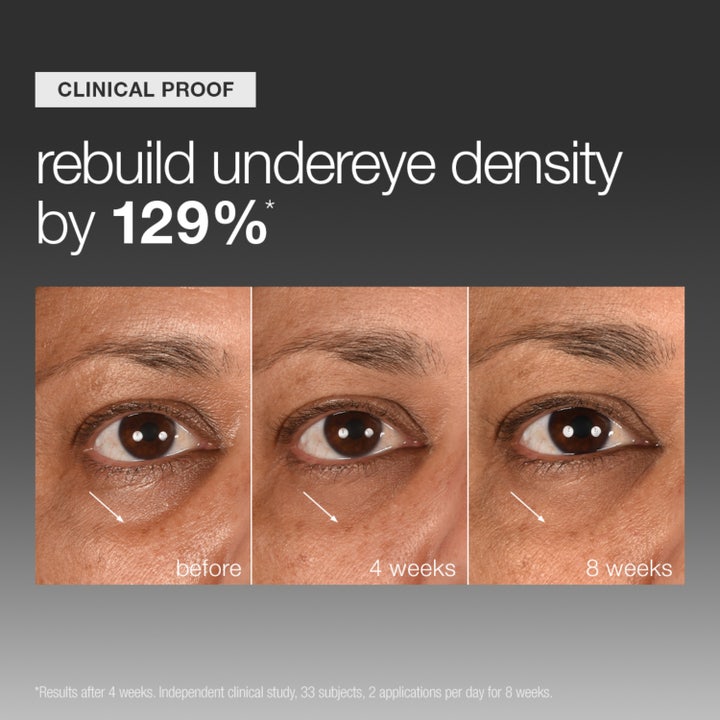 Smart Eye Density
