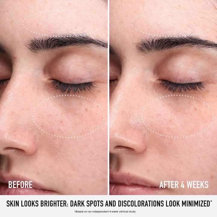 bareMinerals Skin Rescue Pure Glow Serum 30 ml brightening serum visar resultat före och efter på pigmentfläckar.