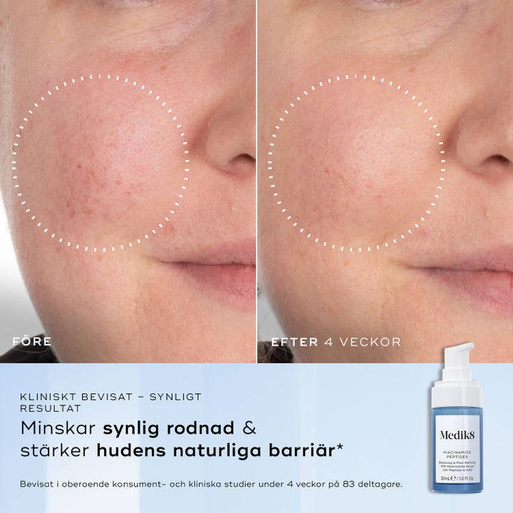 Medik8 Niacinamide Peptides Toner 30 ml ansiktsvatten minskar rodnad i en före och efter bild bredvid en blå pumpflaska.